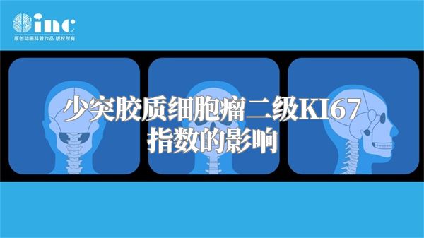 少突胶质细胞瘤二级KI67指数的影响