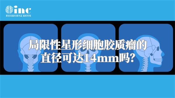 局限性星形细胞胶质瘤的直径可达14mm吗？