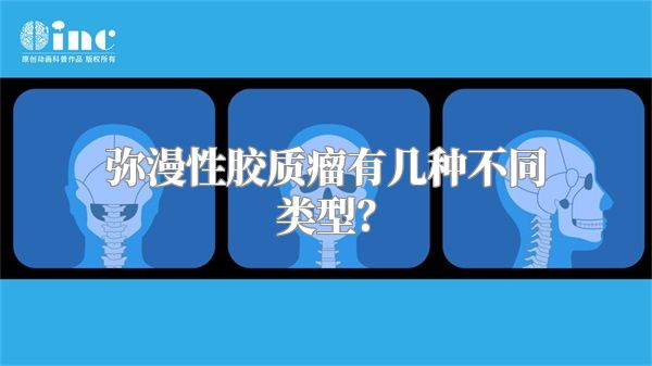 弥漫性胶质瘤有几种不同类型？