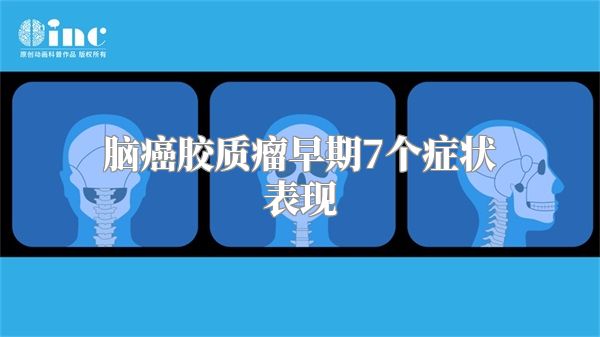 脑癌胶质瘤早期7个症状表现