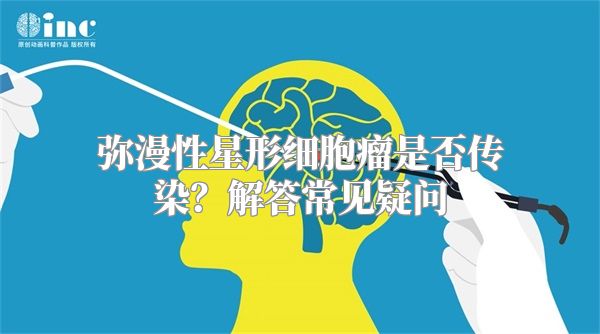 弥漫性星形细胞瘤是否传染？解答常见疑问