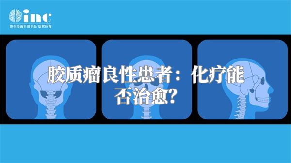 胶质瘤良性患者：化疗能否治愈？