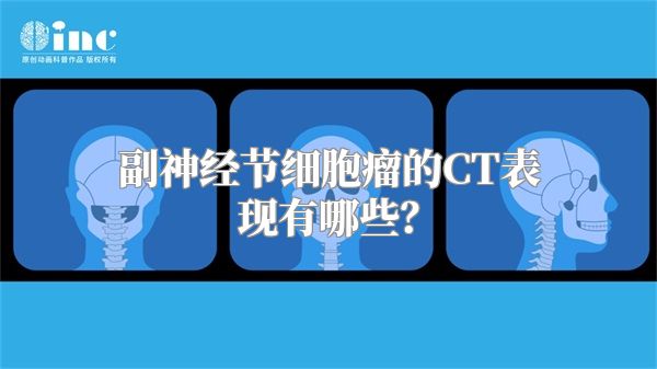 副神经节细胞瘤的CT表现有哪些？