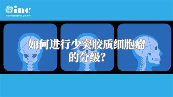 如何进行少突胶质细胞瘤的分级？