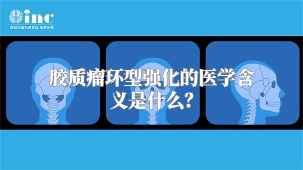 胶质瘤环型强化的医学含义是什么？