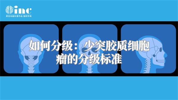 如何分级：少突胶质细胞瘤的分级标准