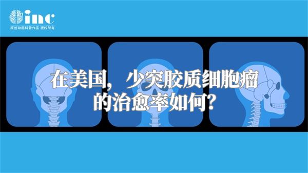 在美国，少突胶质细胞瘤的治愈率如何？