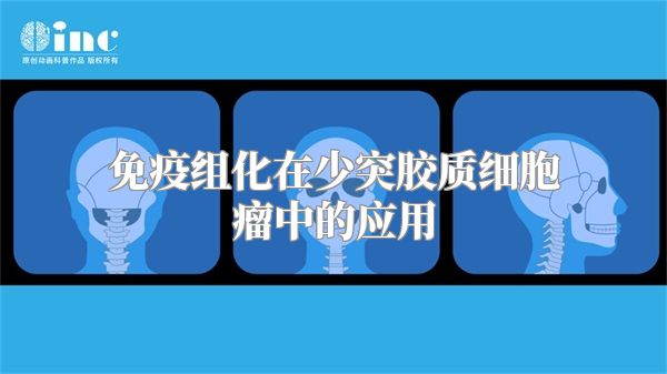 免疫组化在少突胶质细胞瘤中的应用