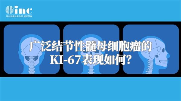 广泛结节性髓母细胞瘤的KI-67表现如何？