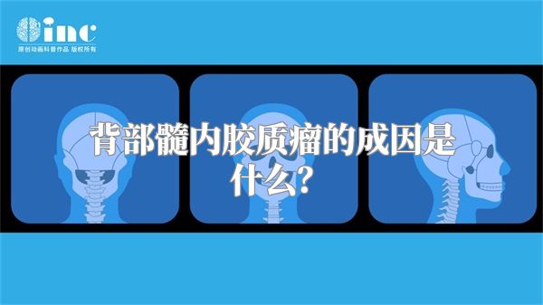 背部髓内胶质瘤的成因是什么？