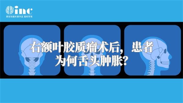 右额叶胶质瘤术后，患者为何舌头肿胀？