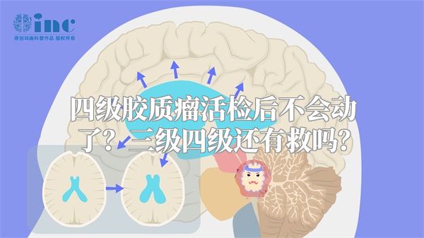 四级胶质瘤活检后不会动了？三级四级还有救吗？