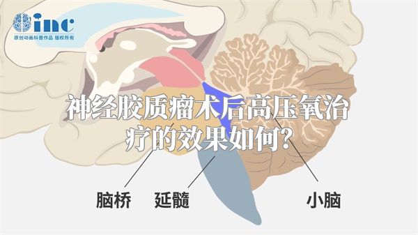 神经胶质瘤术后高压氧治疗的效果如何？