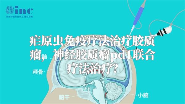 疟原虫免疫疗法治疗胶质瘤，神经胶质瘤pd1联合疗法治疗？