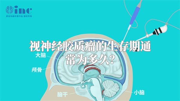 视神经胶质瘤的生存期通常为多久？