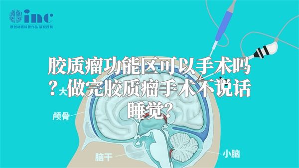 胶质瘤功能区可以手术吗？做完胶质瘤手术不说话睡觉？