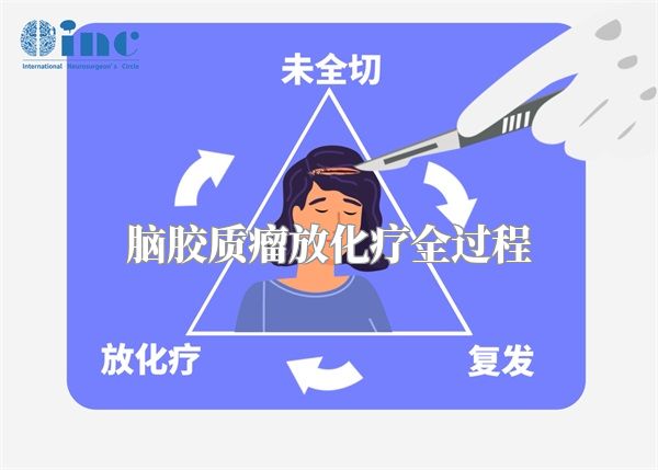 脑胶质瘤放化疗全过程