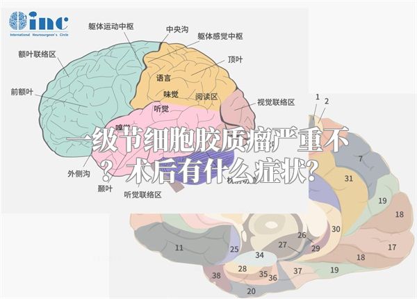 一级节细胞胶质瘤严重不？术后有什么症状？