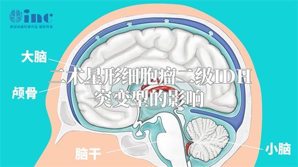 二术星形细胞瘤二级IDH突变型的影响