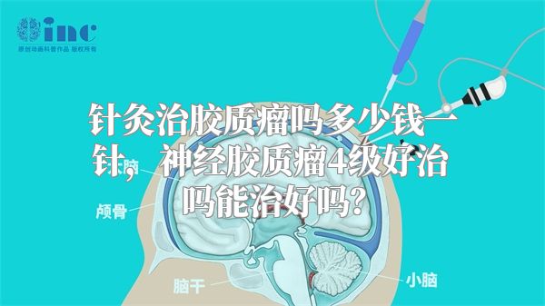 针灸治胶质瘤吗多少钱一针，神经胶质瘤4级好治吗能治好吗？