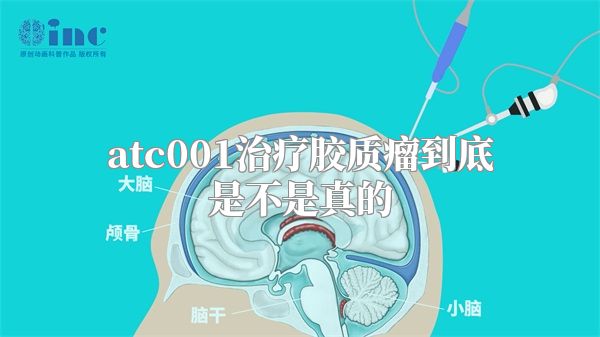 atc001治疗胶质瘤到底是不是真的