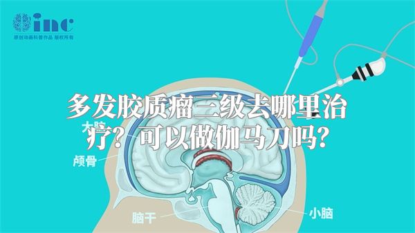 多发胶质瘤三级去哪里治疗？可以做伽马刀吗？