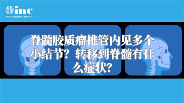 脊髓胶质瘤椎管内见多个小结节？转移到脊髓有什么症状？