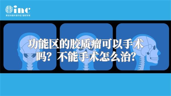 功能区的胶质瘤可以手术吗？不能手术怎么治？