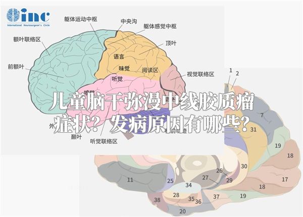 儿童脑干弥漫中线胶质瘤症状？发病原因有哪些？