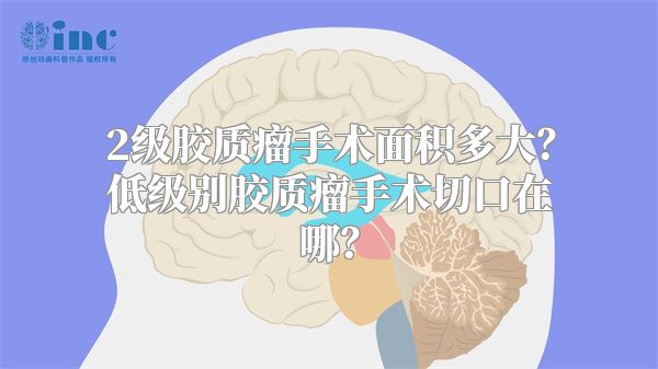 2级胶质瘤手术面积多大？低级别胶质瘤手术切口在哪？