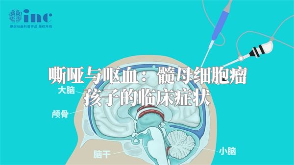 嘶哑与呕血：髓母细胞瘤孩子的临床症状