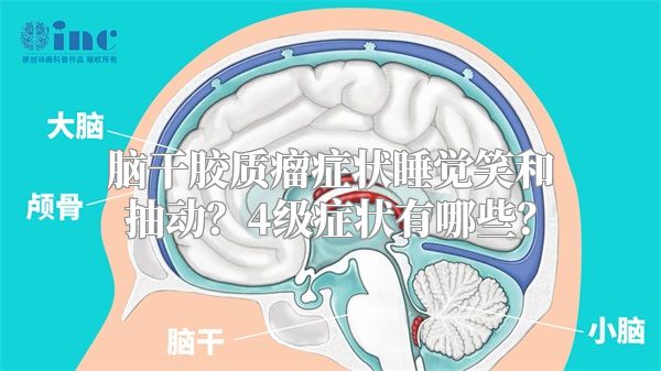 脑干胶质瘤症状睡觉笑和抽动？4级症状有哪些？