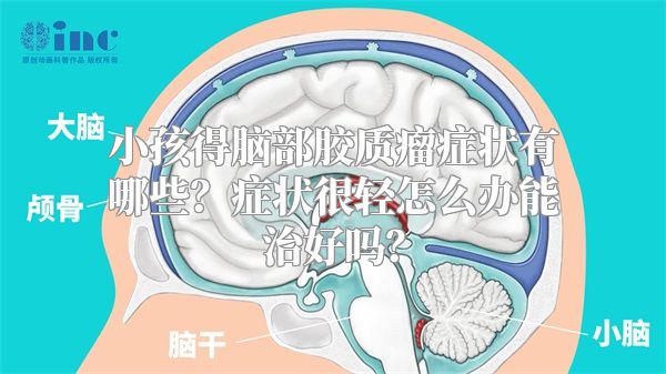 小孩得脑部胶质瘤症状有哪些？症状很轻怎么办能治好吗？