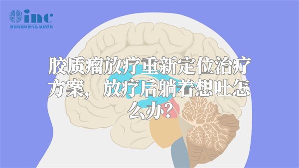 胶质瘤放疗重新定位治疗方案，放疗后躺着想吐怎么办？