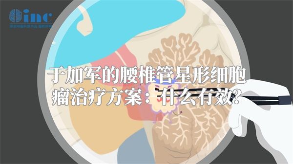 于加军的腰椎管星形细胞瘤治疗方案：什么有效？