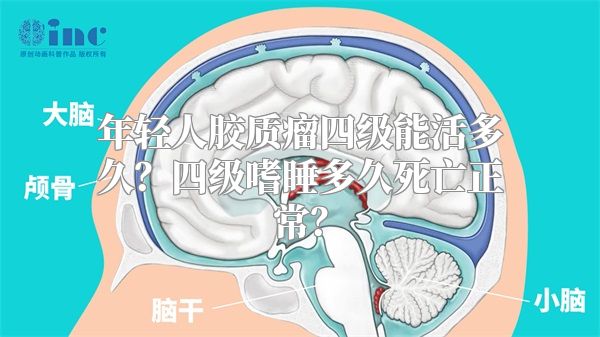 年轻人胶质瘤四级能活多久？四级嗜睡多久死亡正常？