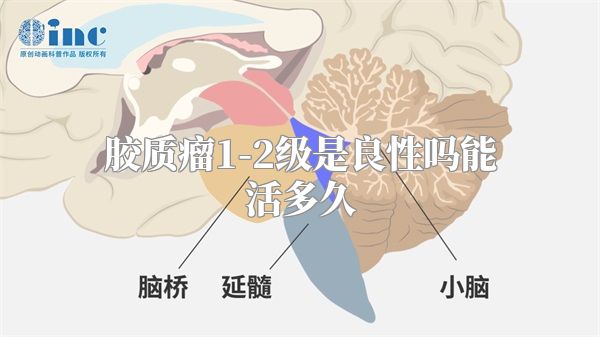 胶质瘤1-2级是良性吗能活多久