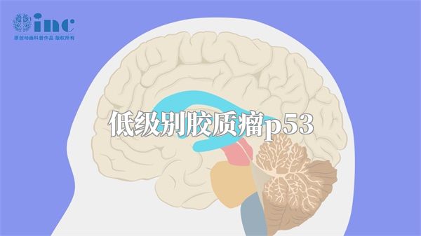 低级别胶质瘤p53