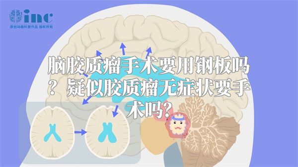 脑胶质瘤手术要用钢板吗？疑似胶质瘤无症状要手术吗？