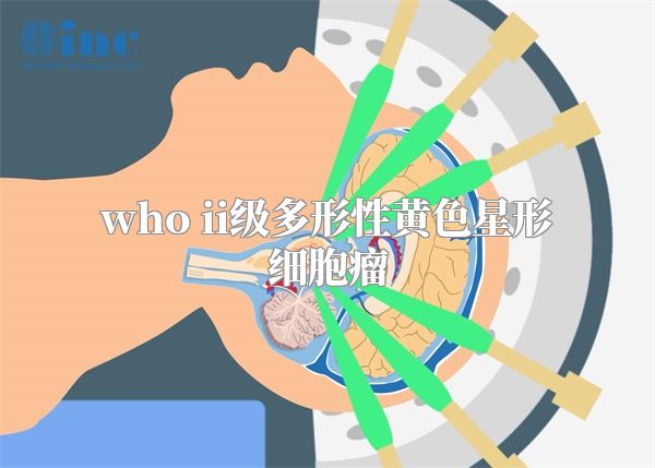 who ii级多形性黄色星形细胞瘤