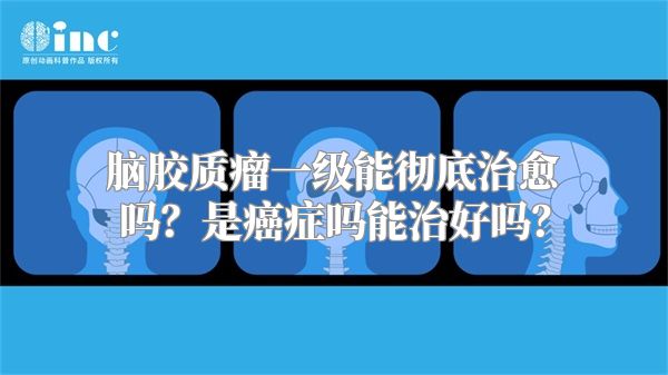 脑胶质瘤一级能彻底治愈吗？是癌症吗能治好吗？