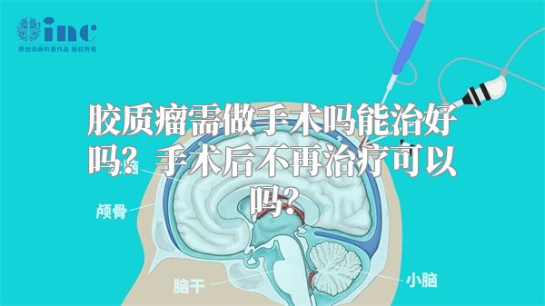 胶质瘤需做手术吗能治好吗？手术后不再治疗可以吗？