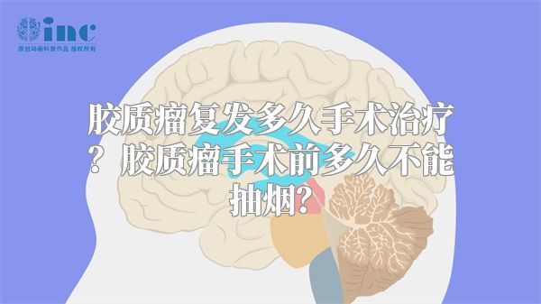 胶质瘤复发多久手术治疗？胶质瘤手术前多久不能抽烟？