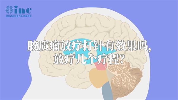 胶质瘤放疗打针有效果吗，放疗几个疗程？