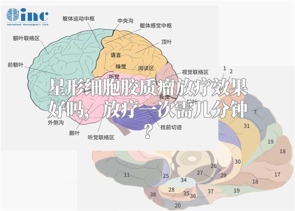 星形细胞胶质瘤放疗效果好吗，放疗一次需几分钟？