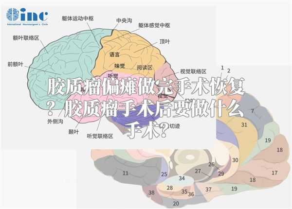 胶质瘤偏瘫做完手术恢复？胶质瘤手术后要做什么手术？