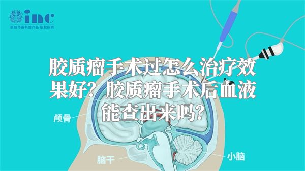 胶质瘤手术过怎么治疗效果好？胶质瘤手术后血液能查出来吗？