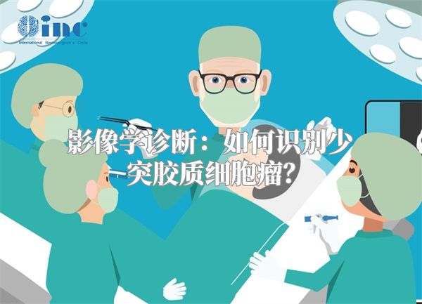 影像学诊断：如何识别少突胶质细胞瘤？