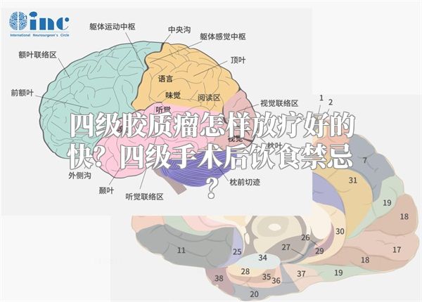 四级胶质瘤怎样放疗好的快？四级手术后饮食禁忌？