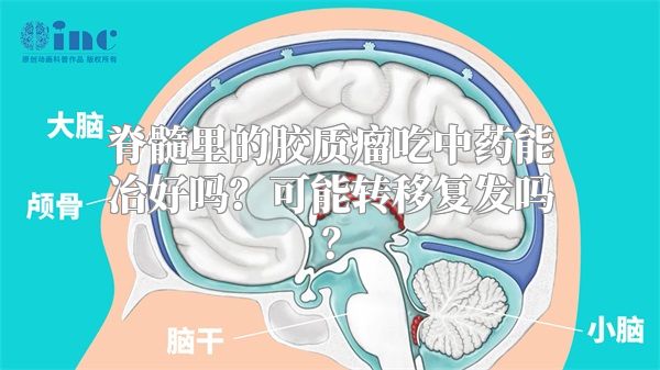 脊髓里的胶质瘤吃中药能冶好吗？可能转移复发吗？